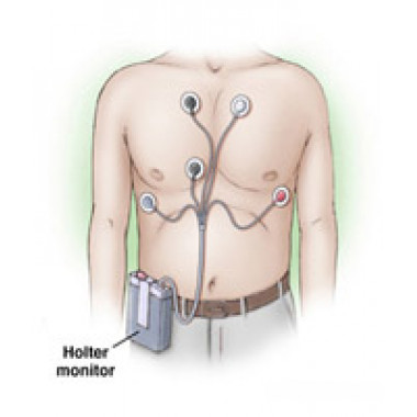 Holter Monitor