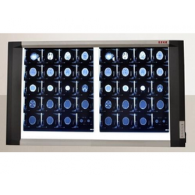 X-ray view box