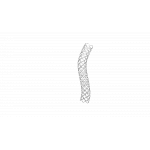 Bare Metal Coronary Stent